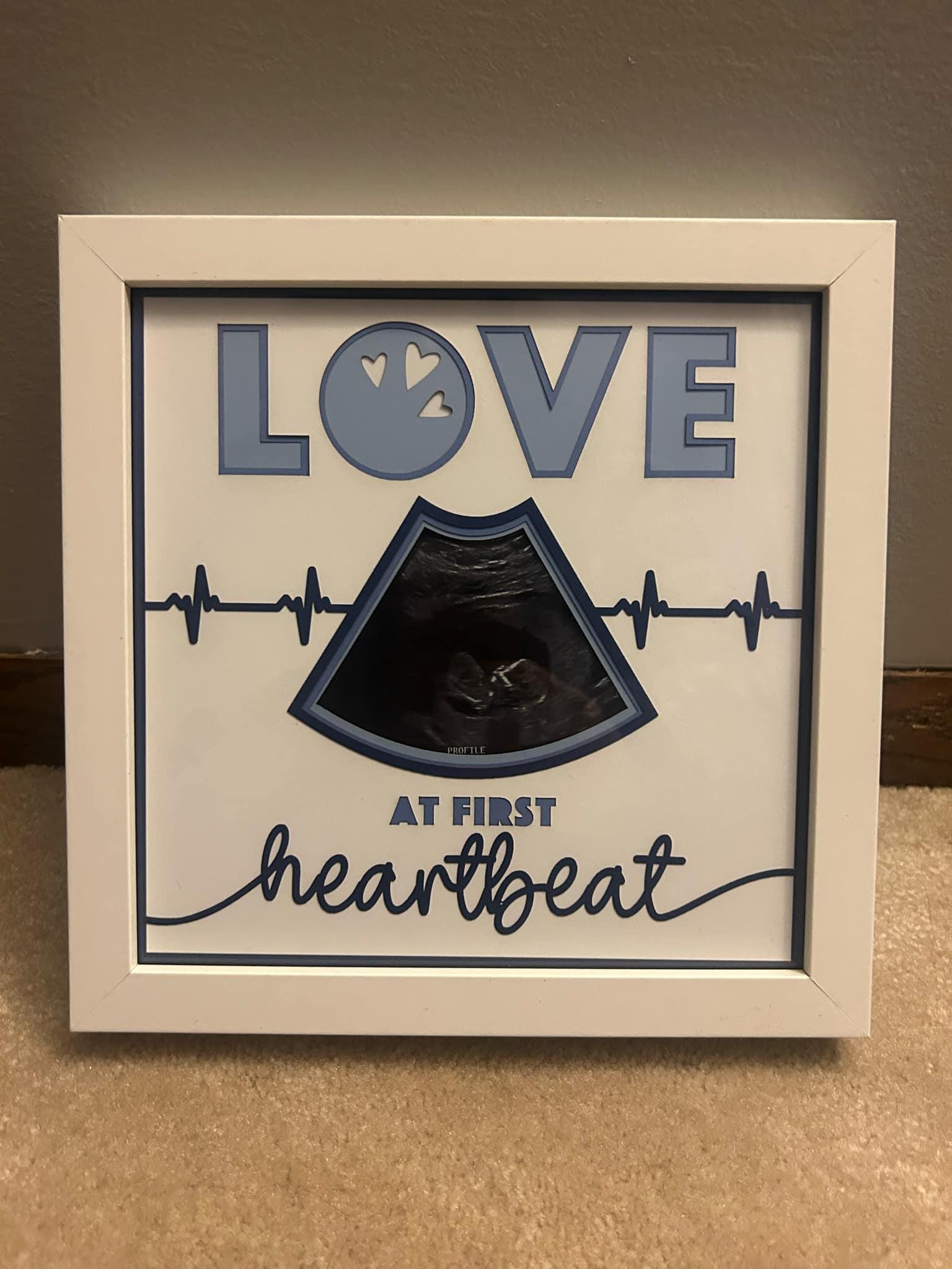 love at first site baby ultrasound picture frame 