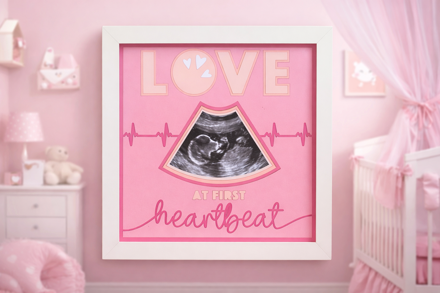 love at first site baby ultrasound picture frame 